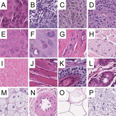 Deep learning for the detection of anatomical tissue structures and neoplasms of the skin on scanned histopathological tissue sections